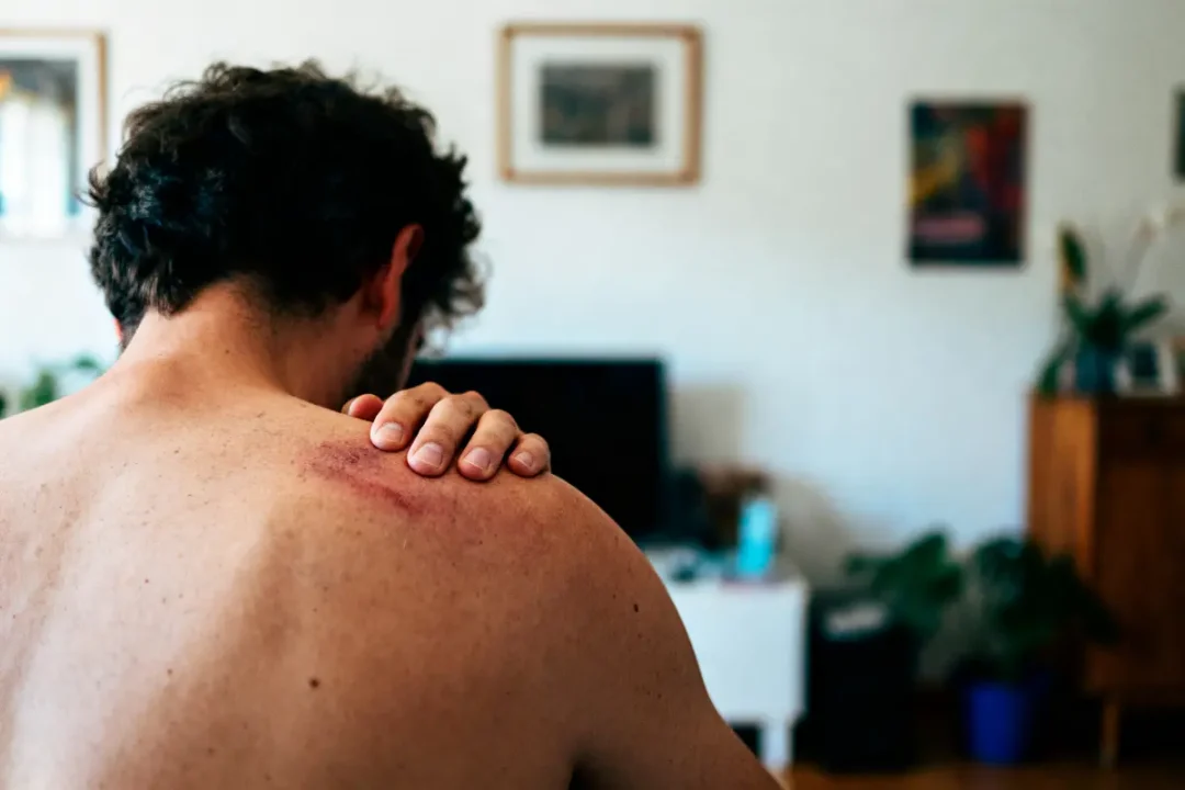 Homme torse nu, se tenant l'épaule avec égratignure visible, dans un salon.