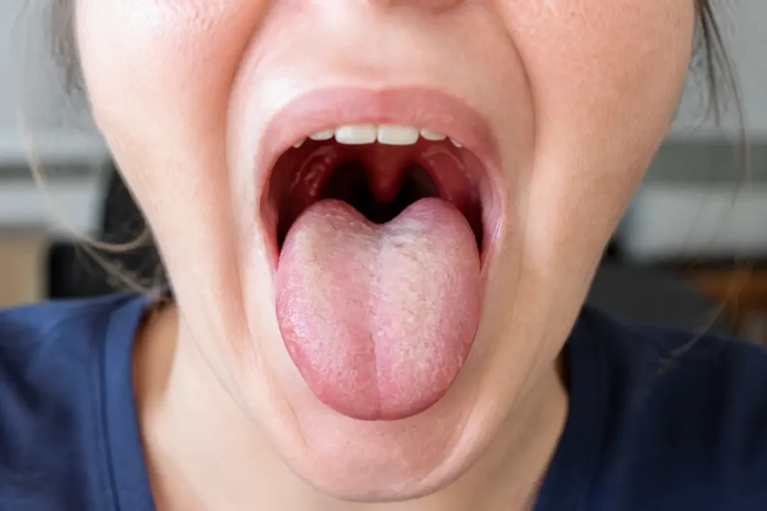 Personne tirant la langue avec la bouche grande ouverte, mettant en évidence la langue et les dents.
