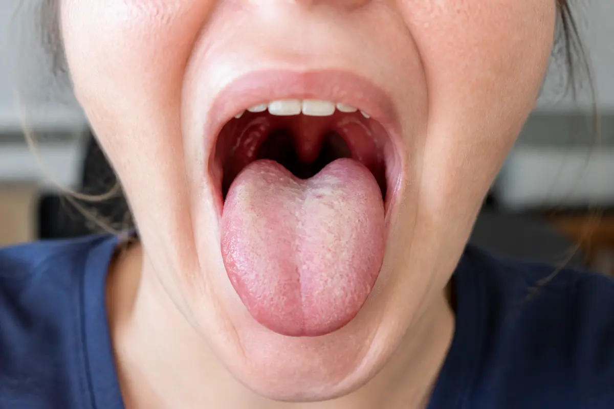 Personne tirant la langue avec la bouche grande ouverte, mettant en évidence la langue et les dents.